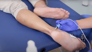 19 Neuromodulación nervio tibial