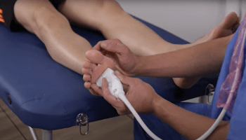 Ecografía Neuroma de Morton