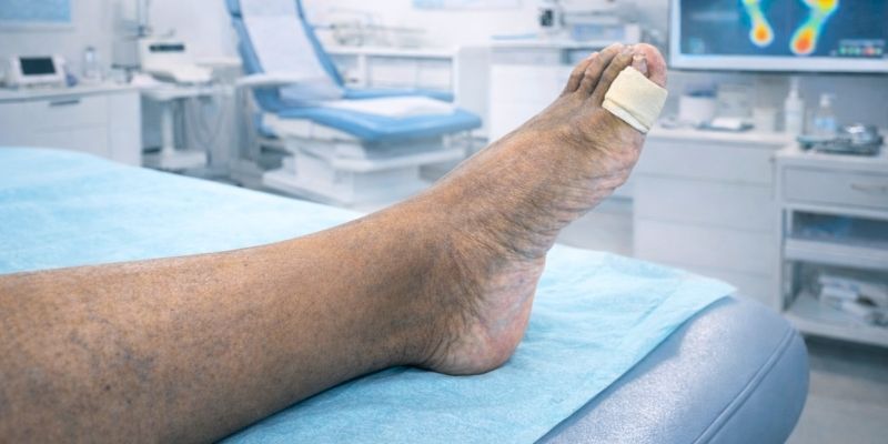 Curso pie diabético